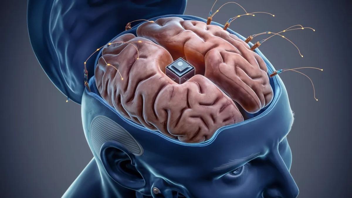 Neuralink