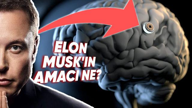 Elon Musk, Bir Felakete Neden Olabilir! Neuralink’in İnsan Beynine Taktığı Çip, Tam Olarak Ne İşe Yarıyor ve Nasıl Çalışıyor?