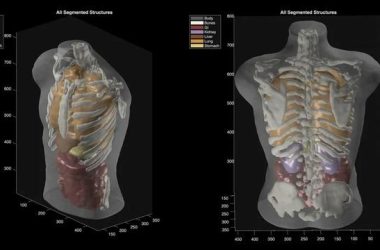 Midjourney Scanner ile Sağlıkta Devrim: Ultrason Teknolojisi ve Spa Deneyiminin Geleceği