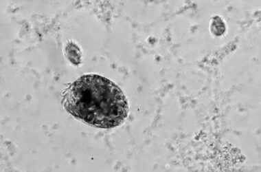 İstediği Zaman ‘Hulk Gibi Dönüşen’ Mikrop Türü Keşfedildi